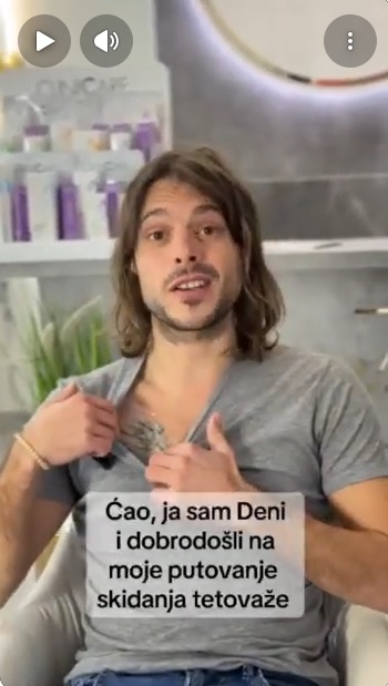 Skidanje tetovaže