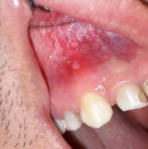 ORALNA MEDICINA