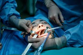 ORALNA HIRURGIJA I IMPLANTOLOGIJA